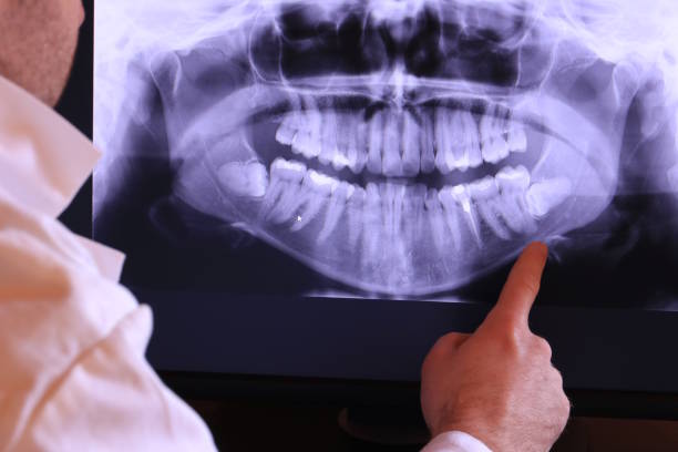 Best Chipped Tooth Repair Near Me  in Cortland, OH